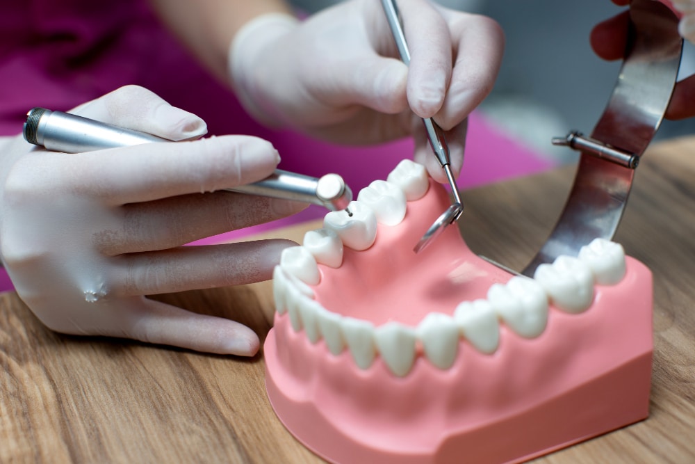 Protesis dentales sobre implantes - Laboratorio Dental Valle